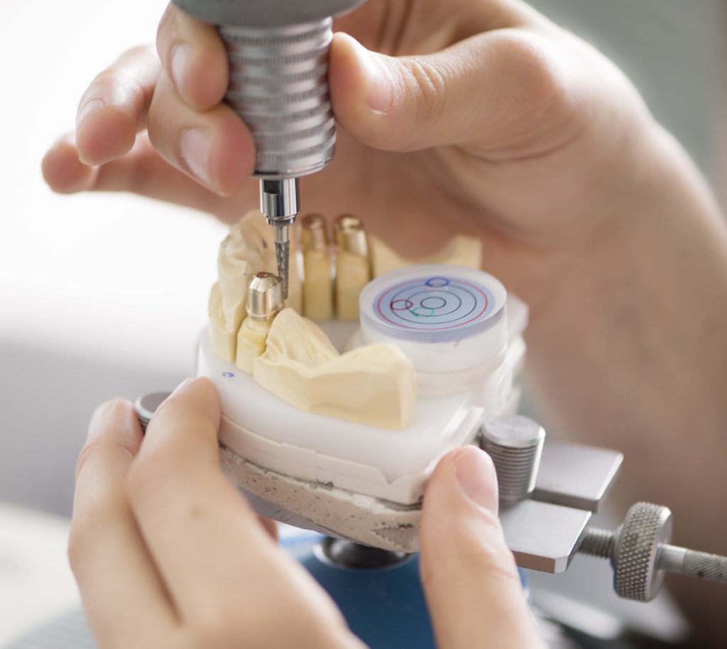Detailaufnahme eines Technikers, der an Zahnersatz im Dentallabor arbeitet, wobei verschiedene Schritte des Fertigungsprozesses sichtbar sind.