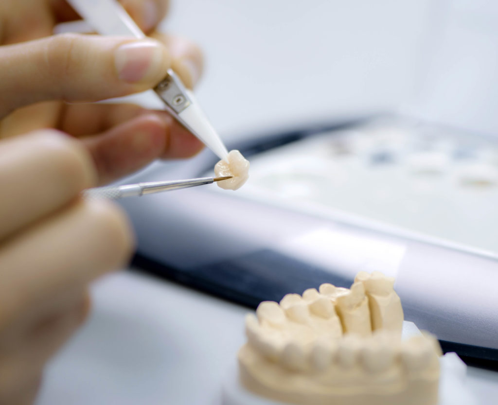 Detailaufnahme eines Technikers, der an Zahnersatz im Dentallabor arbeitet, wobei verschiedene Schritte des Fertigungsprozesses sichtbar sind.