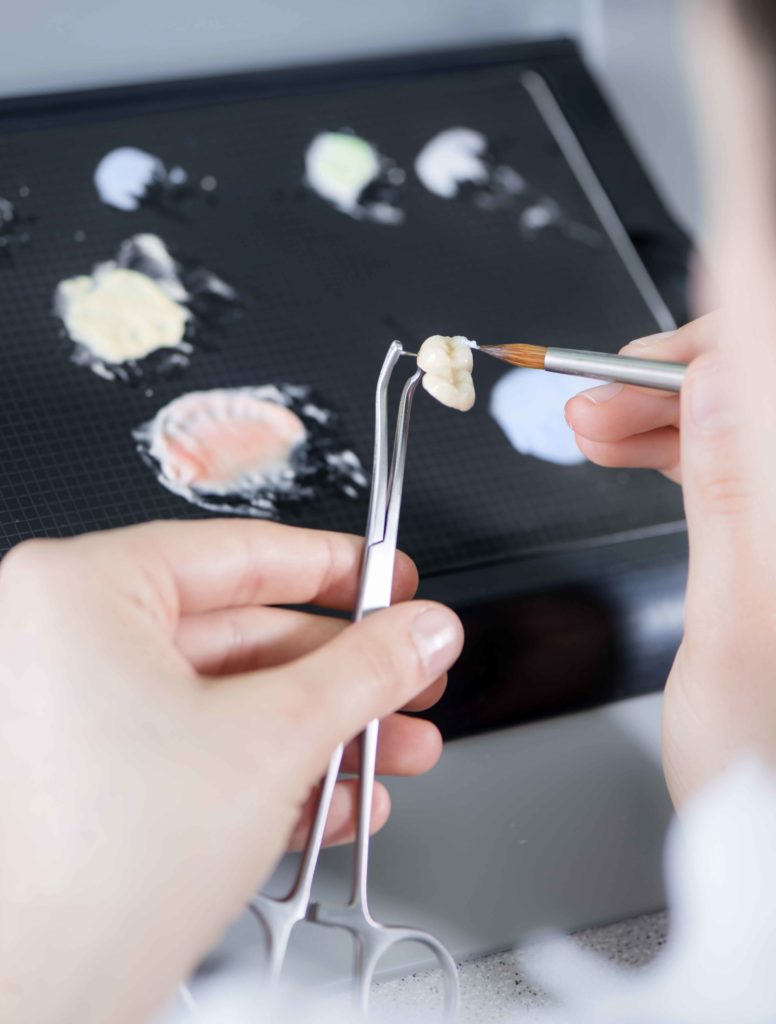 Detailaufnahme eines Technikers, der an Zahnersatz im Dentallabor arbeitet, wobei verschiedene Schritte des Fertigungsprozesses sichtbar sind.