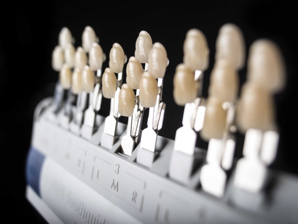 Detailaufnahme von aufgereihten Zahnersatzkronen im Dentallabor, die sorgfältig zur Fertigung vorbereitet sind.