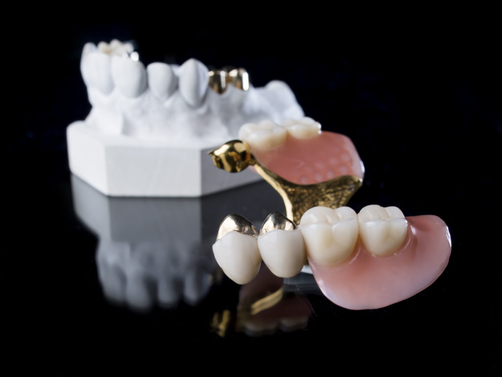 Klare Aufnahme einer Zahnprothese im Dentallabor, die detailliert die Form und Struktur der Prothese zeigt.