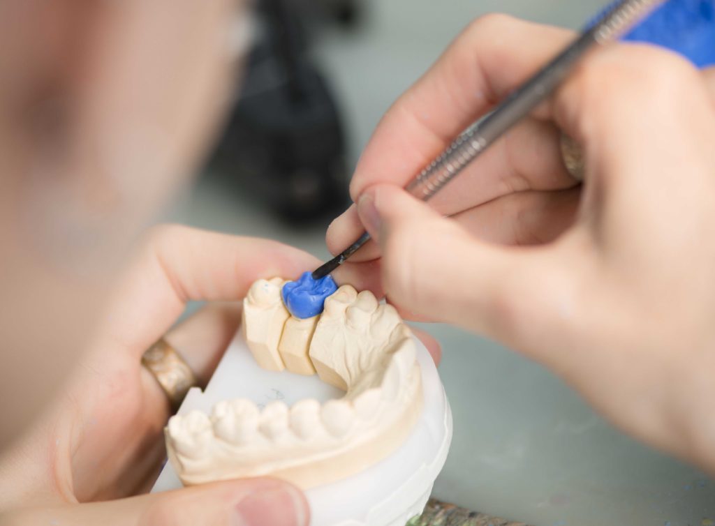 Detailaufnahme eines Technikers, der an Zahnersatz im Dentallabor arbeitet, wobei verschiedene Schritte des Fertigungsprozesses sichtbar sind.