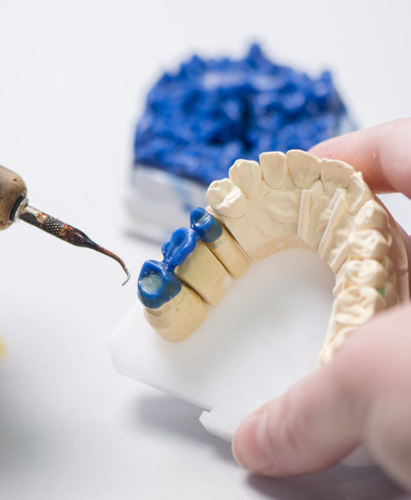 Detailaufnahme eines Technikers, der an Zahnersatz im Dentallabor arbeitet, wobei verschiedene Schritte des Fertigungsprozesses sichtbar sind.